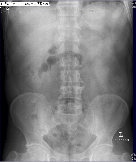 Abdomen.jpg