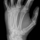 Mittelhand_seitl_2.jpg